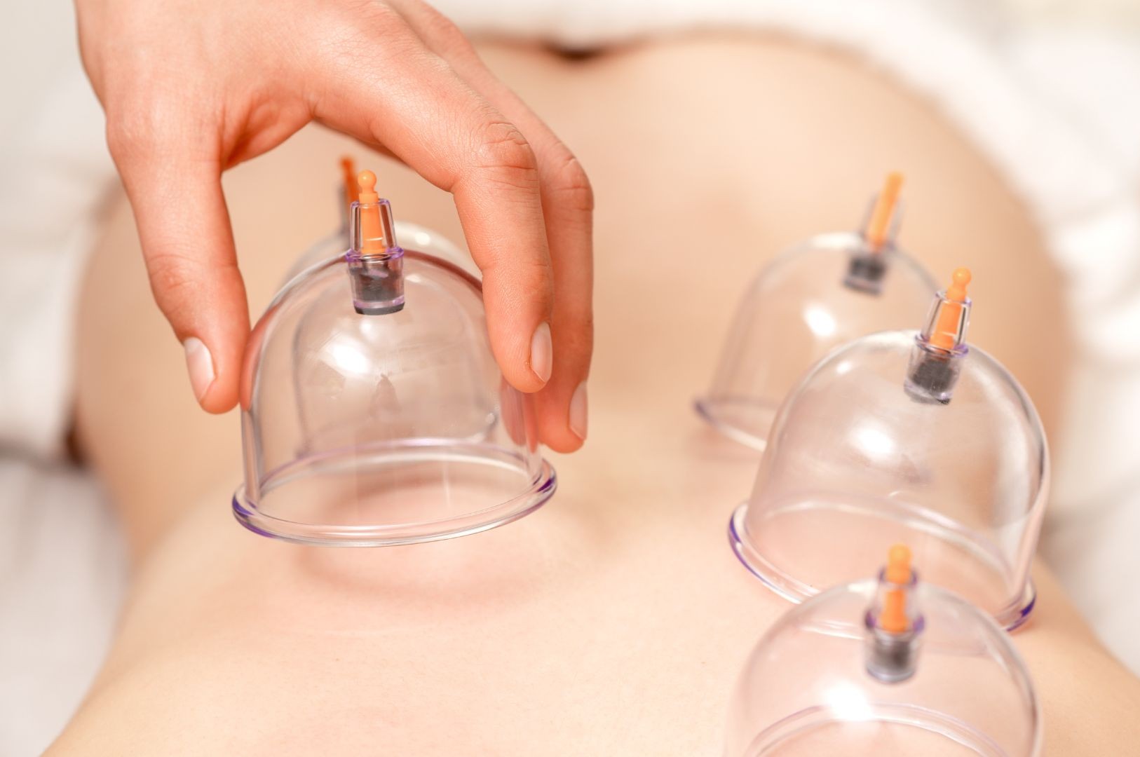 cupping enhancement