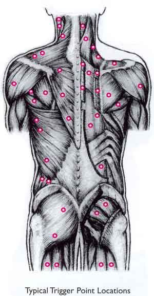 massagepain